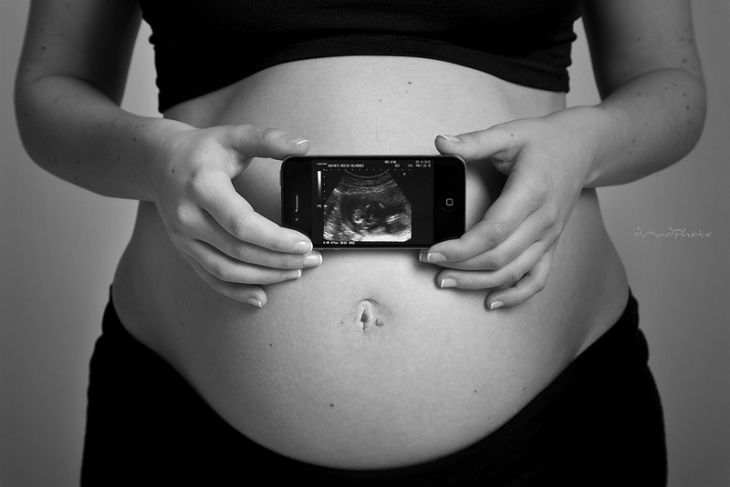 Second-trimester ultrasound